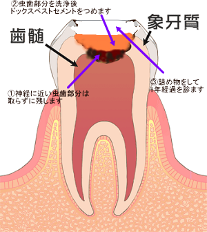 ドックベスト