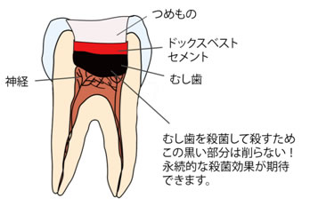 ドックベスト